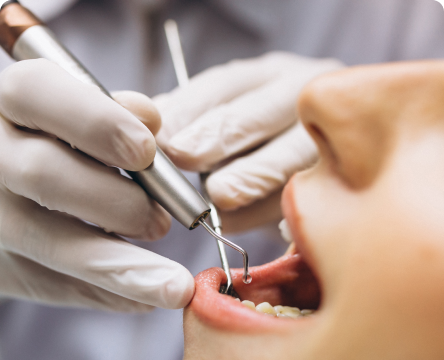 Diş Ağrısı Neden Olur?  En Yaygın 7 Sebep