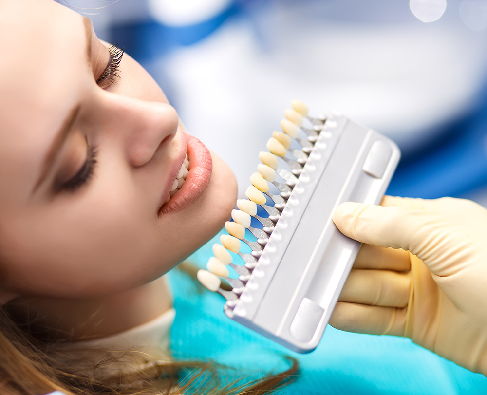 Diş Beyazlatma Yöntemleri: Evde mi, Klinik mi?